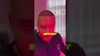 Day 5 Hair Transplant Progress