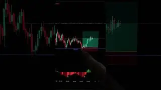 Im so tired of seeing this when daytrading