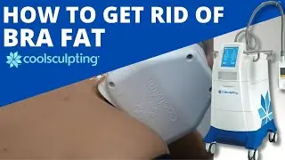 BRA FAT Removal using Coolsculpting.