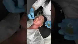 Техника послойного нанесения разных пилингов M.A.D skincare в одной программе.