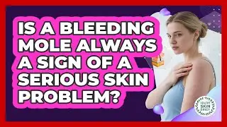 Is A Bleeding Mole Always A Sign Of A Serious Skin Problem? - Healthy Skin Brief