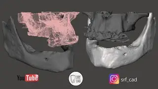 3D SLICER MESHMIXER DENTAL : Tutorial come convertire un file DCM in STL  DICOM CBT