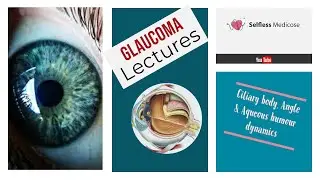 ciliary body and anterior chamber angle and aqueous humour for GLAUCOMA part 1