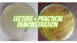 Bacterial Culture | Media Preparation | Microbiology | Culture Sensitivity Test | Growth Media