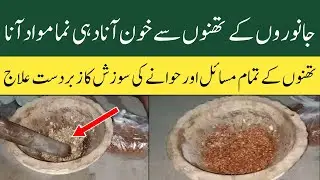 Thunno Mein Khoon Aana | Dahi Numa Doodh Aana | Hawana Mein Sozish Ka Desi Elaaj