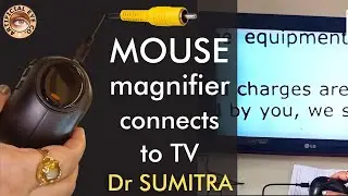 Economical Mouse magnifier connects to large tv screen | Dr Sumitra