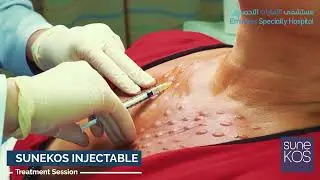 SuneKOS wrinkles treatment | Dr.Souzan Decollete - 2