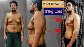 ANIRUDH LOST HIS BIG MAN BOOBS | 31kgs Gone!! | NO SURGERY