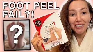 I Tried a Babyfoot Peel - Did it work?
