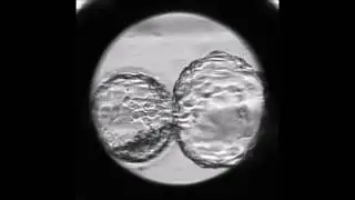 Human frozen-thawed blastocyst morphokinetics observed using time-lapse cinematography reflects