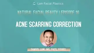 Dallas Cosmetic Surgery Podcast: Acne Scarring Correction