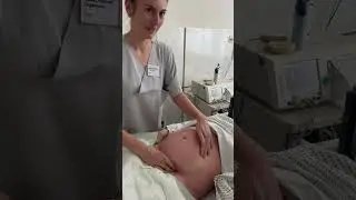 ECV soft touch, &auml;u&szlig;ere Wendung, Beckenendlage in Sch&auml;dellage, external cephalic version