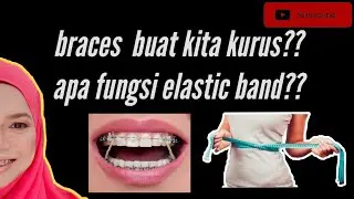Damon Braces part 5:braces buat kita kurus?? apa fungsi elastic band??