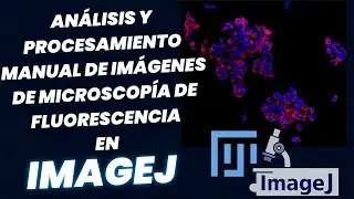 An&aacute;lisis y procesamiento manual de im&aacute;genes de microscop&iacute;a de fluorescencia en ImageJ