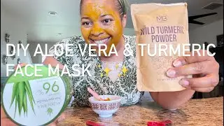 HOW TO REDUCE ACNE SCARS AND HYPERPIGMENTATION FAST✨ DIY TURMERIC AND ALOE FACE MASK