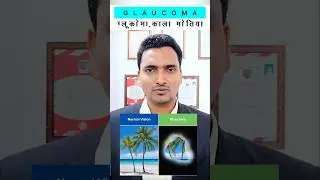 काला मोतिया का ईलाज | Glaucoma treatment in hindi | #shorts #glaucoma