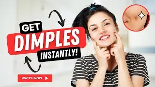 Dimpleplasty Surgery Cost, Recovery, Before & After | Get Natural Dimples | Scar-Free Procedure!