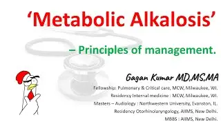 Metabolic alkalosis - Principles of management?