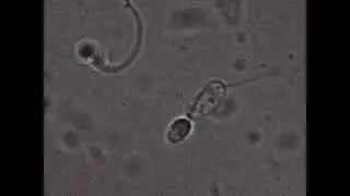 Limfocyty T-(CD8⁺) atakujący mitochondria plemnika. 2000x