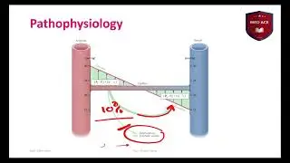 Peripheral edema