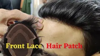 Front Lace Hair Patch l Natural Hair Patch l Mirage hair patch l