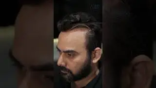 Non-Surgical Hair Fixing: 100% Natural Human Hair Transformation in Just 2 Hours | No Pain, All Gain