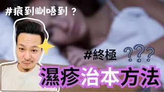 濕疹剋星㊙️：9種 Chalcone 明日葉，皮膚從此告別痕癢紅腫！🔥