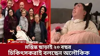 Man goes 20 years without brain, doctors say it's a miracle | Without Brain |Human Body | Jamuna Ty