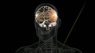 Dr. Perry  - Concussion Diagnosis