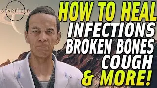 STARFIELD TIPS & TRICKS - How To Cure Status Effects (Broken Bones, Coughs, Sprains, & More)