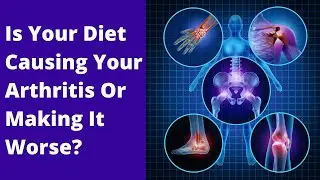 Is Your Diet Causing Your Arthritis Or Making It Worse? Keto Dr Berry Explains.