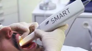 Smart Aligner - Scan Service