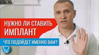 Нужно ли устанавливать зубной имплант? Мосты, съемные протезы, импланты | Стоматолог Доктор Коннов