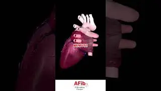 How Fast Can SVT Make Your Heart Go?