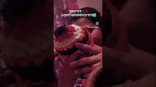 সূচ❌ভালোবাসা দাগ✅#youtubeshorts #youtube #views #viral #share #like #comment #subscribe #baby #mom