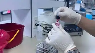 ABO/Rh Grouping (Tube test)