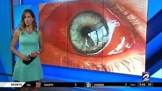What causes red eyes when swimming?