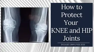 How to Protect Your Joints