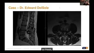 Identifying the Ideal VBO Patient: Clinical Decision Making with Dr. Edward DelSole