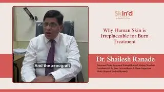 The Healing Power of Human Skin in Burn Treatment | Medical Insight