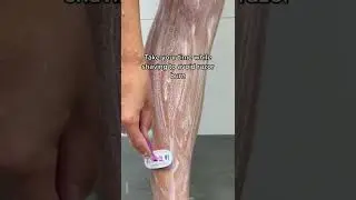 How To Get Rid of Strawberry Legs For GOOD!