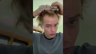 A reason to not give up on your hair! (I never got a transplant)