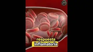 FRIO O CALOR ? EN UNA LESI&Oacute;N AGUDA? 🥶🔥