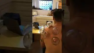 Dynamic Sports Cupping 🔥 #cupping #massage #chiropractic #acupuncture #sandiego #training #tennis