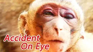 ACCIDENT ON EYES PITY LUCAS MONKEY...!! SAD AND HURT WITH BAD PROBLEM.