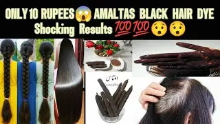 Black Your White Hairs In Just 10 Rupees remedy by Billokadhaaba || Amaltas hair dye and shampoo ||