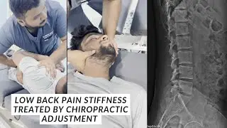Low Back Pain Relief | Stiffness Treated with Chiropractic Adjustment | Chiropractic treatment 