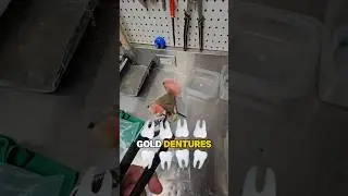 Turning smiles into savings!     Watch as we melt down gold teeth for cash.