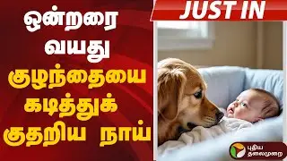 #justin |  ஒன்றரை வயது குழந்தையை கடித்துக் குதறிய நாய்  | Dog Bite