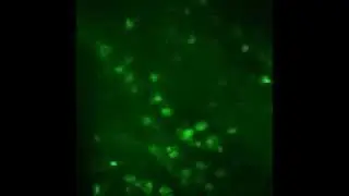 Calcium Imaging of Neurons